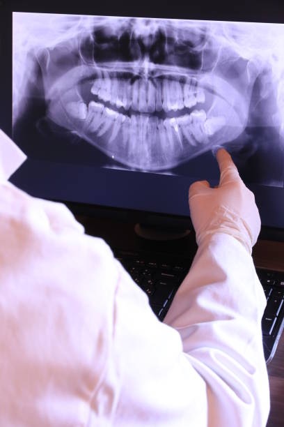 Best Broken or Chipped Tooth Repair in Lanett, AL