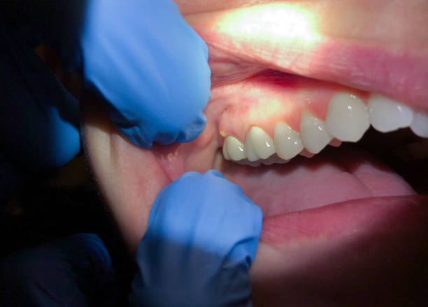 Best Emergency Treatment for Jaw Pain or Injury in Lanett, AL